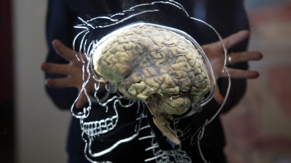 A brain sits inside a glass etching of a human skull.