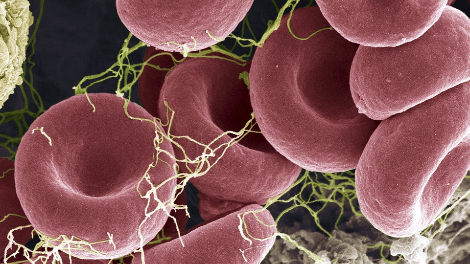 A blood clot, seen through a scanning electron microscope