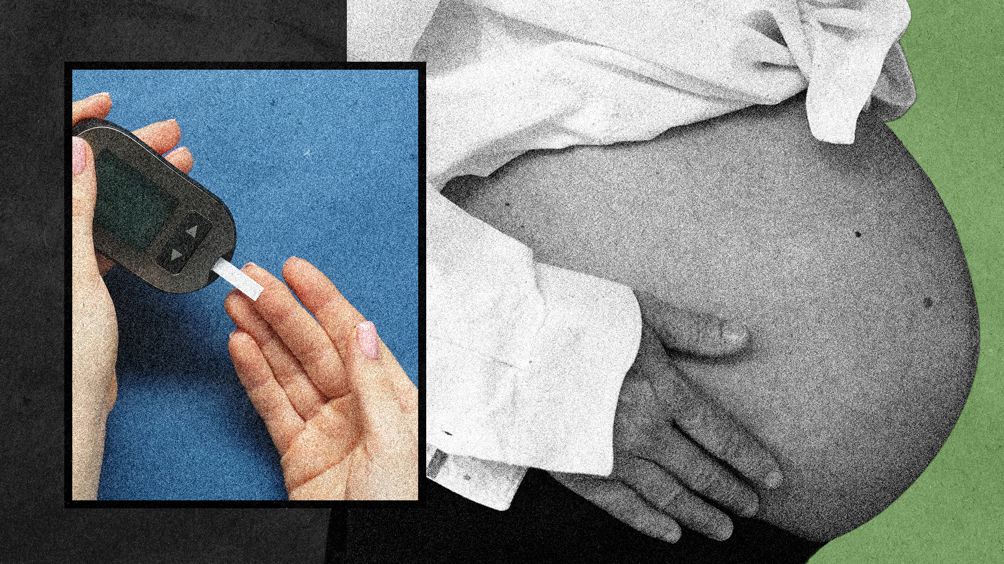 A Mystery About Diabetes in Pregnancy