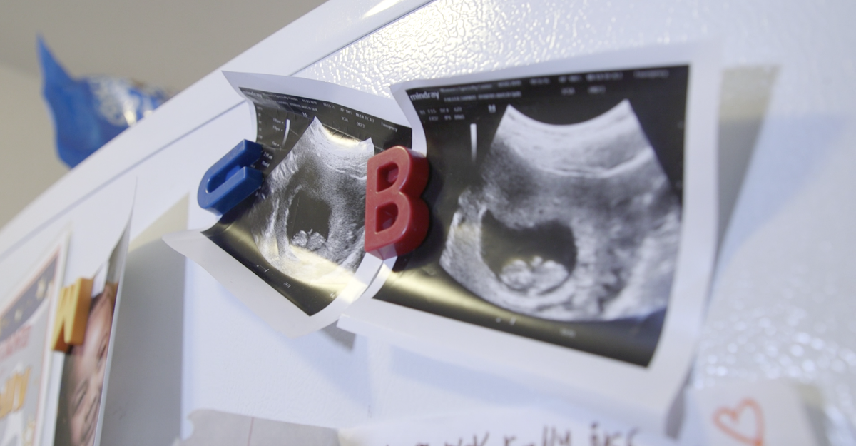 How Where A Woman Lives Can Affect Her Pregnancy The Atlantic