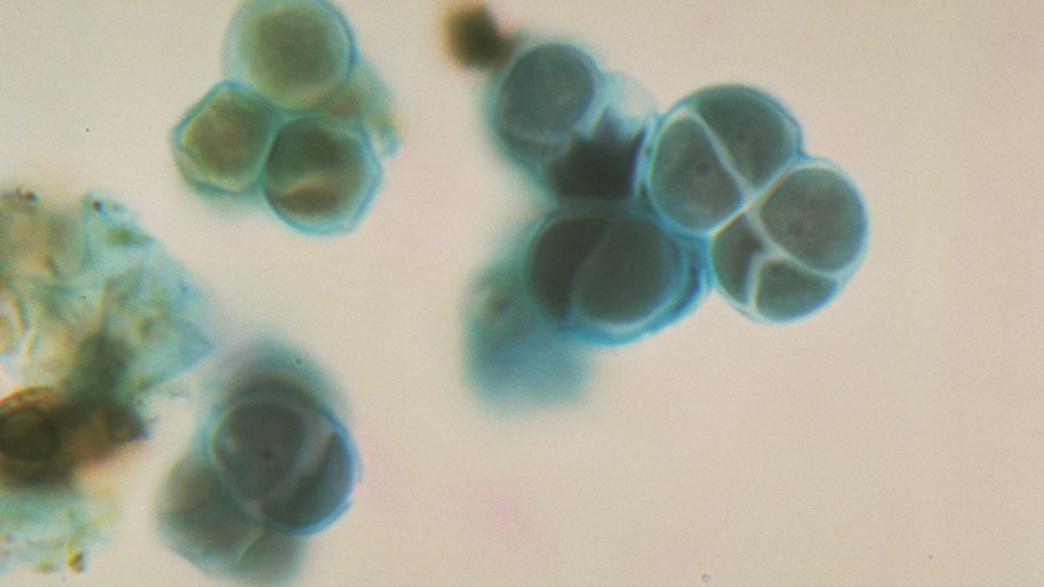 Protococcus blue-green algae, or cyanobacteria
