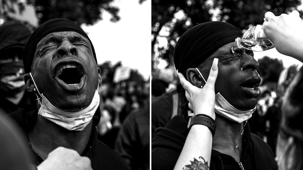 A protester, immediately after being teargassed and pepper sprayed