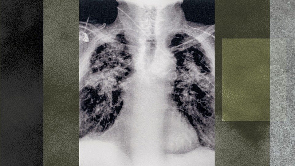 An X-ray image from the 20th century
