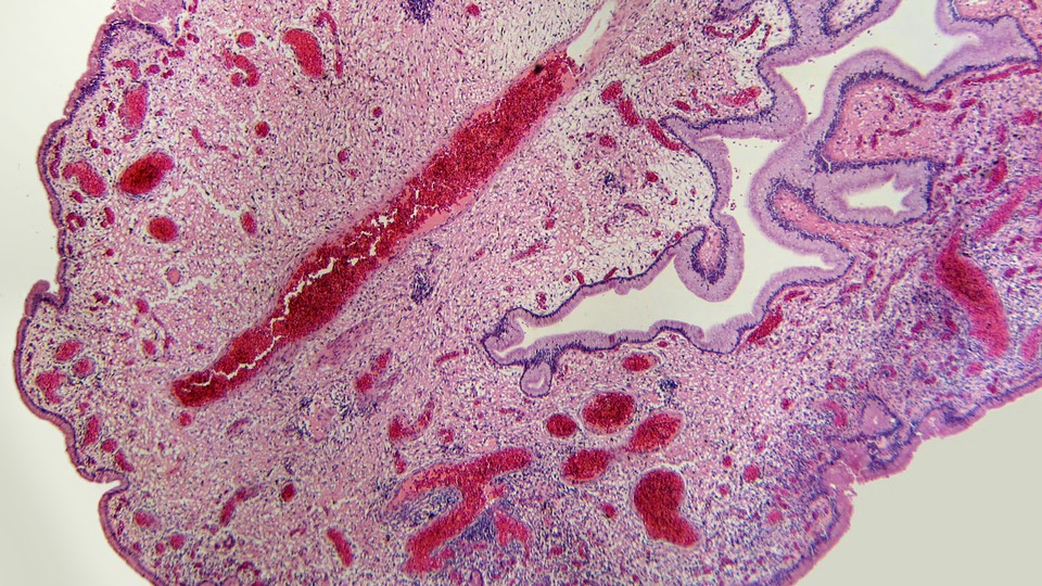 A cellular view of the uterine lining during a pregnancy, which forms the maternal side of the placenta. This image shows the columnar epithelial cells, the stromal cells, and the abundant vascularization of this tissue.