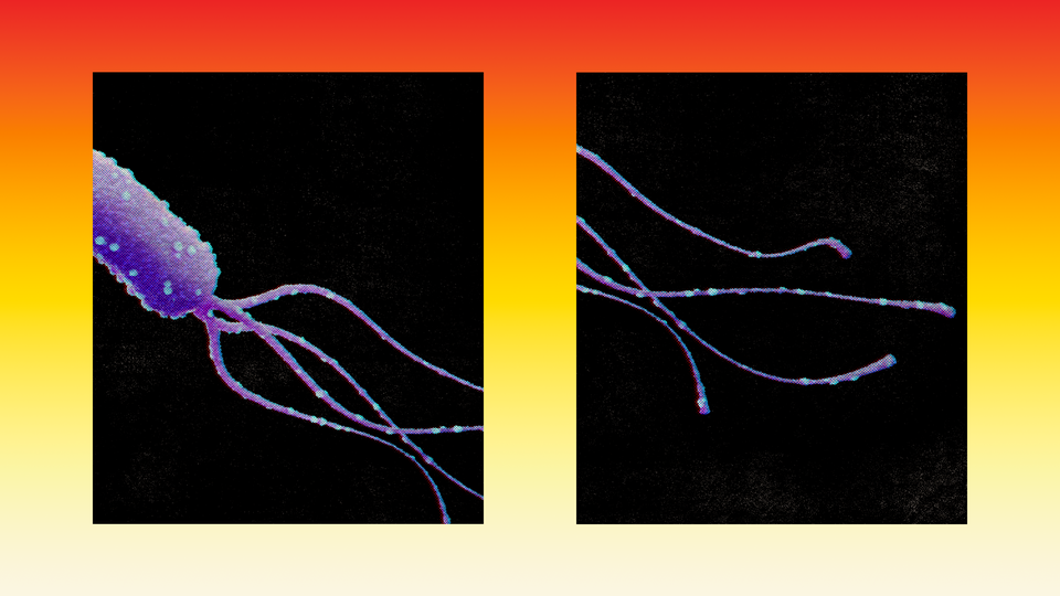 the bacteria h pylori in purple adorned with blue dots swims across two black squares inset into a background that fades from red to yellow