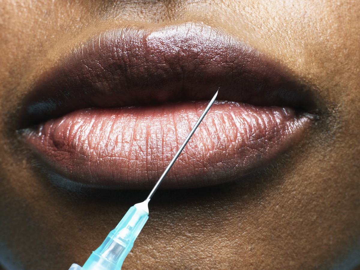 Cosmetic Surgery And The New Black Body The Atlantic