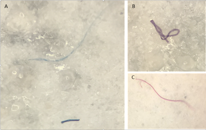 Examples of fibers from trench amphipods (Lauren Brooks / Newcastle University)