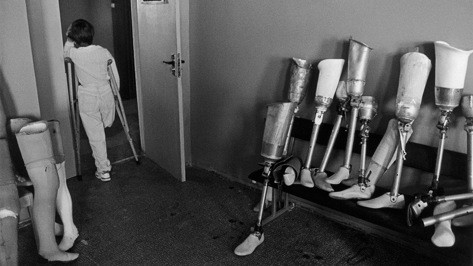 Black-and-white photo of a person standing with crutches in the doorway of a room containing prosthetic legs.