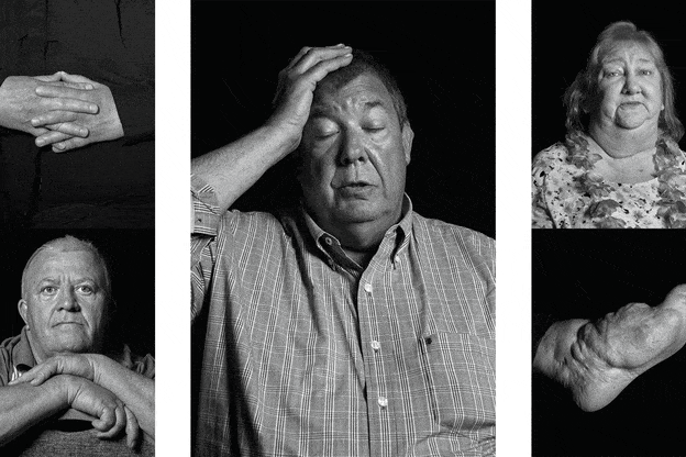 gif of multiple black-and-white photographs of lightning-strike survivors and scars