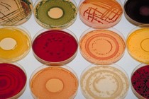 Bacteria cultures of different colors grown on petri plates