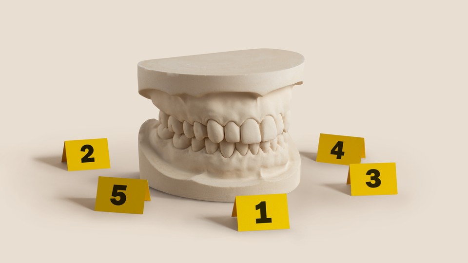 An illustration showing a dental plaster surrounded by evidence markers