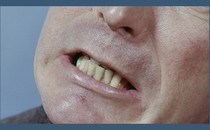 An image of a man clenching his teeth