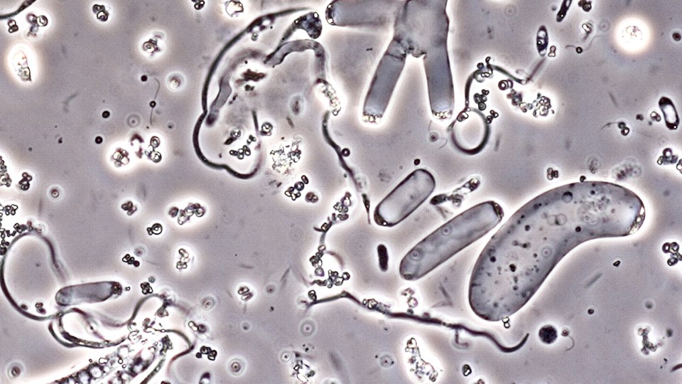 Nephromyces cells under a microscope.