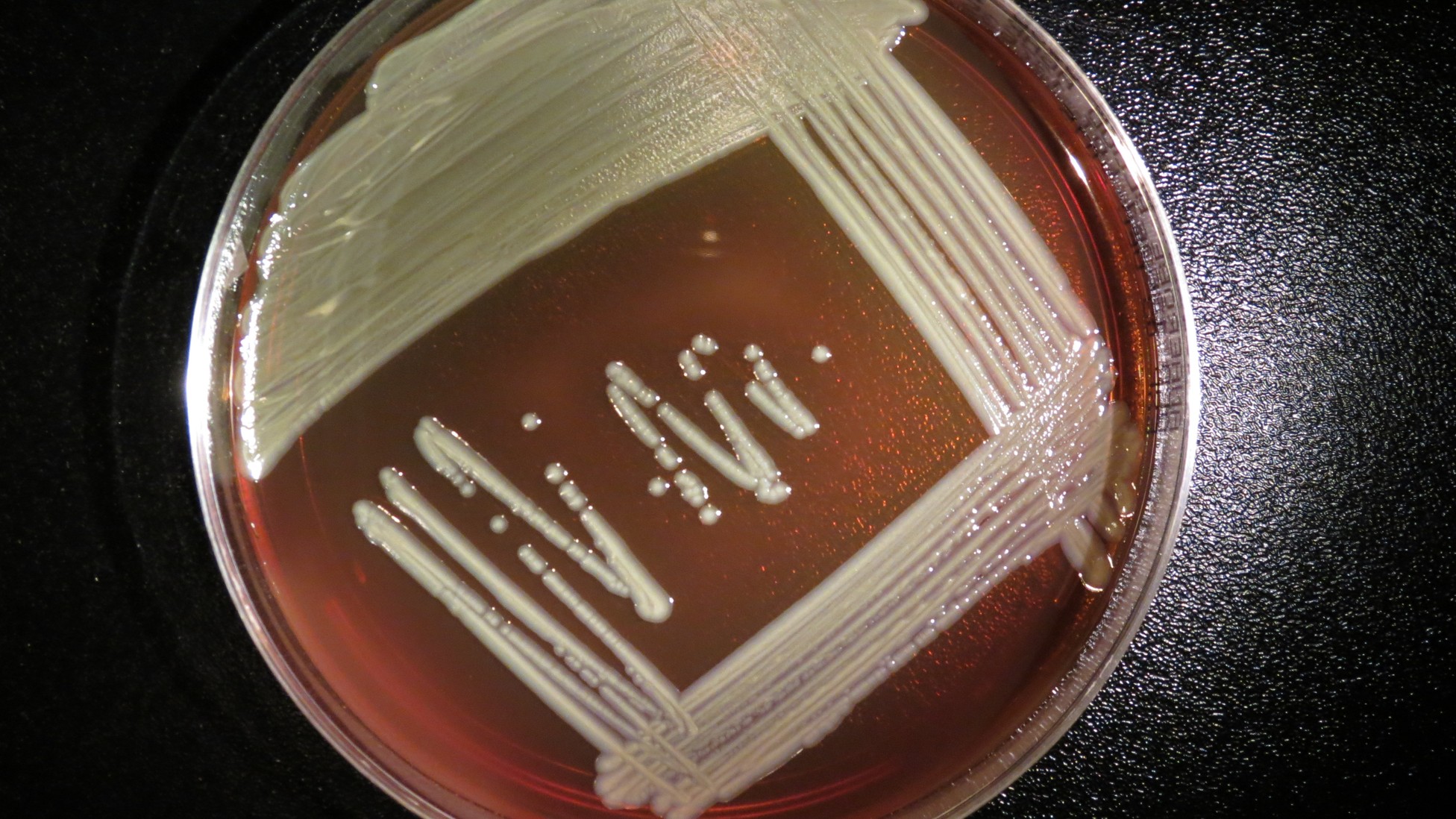 How a Usually Harmless Bacteria Ended Up Killing 18 People in Wisconsin