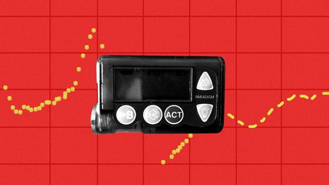 Why are people buying old insulin pumps?