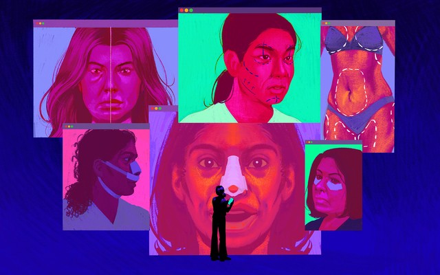 Illustration of social media screens with womens faces, pre and post cosmetic surgery.