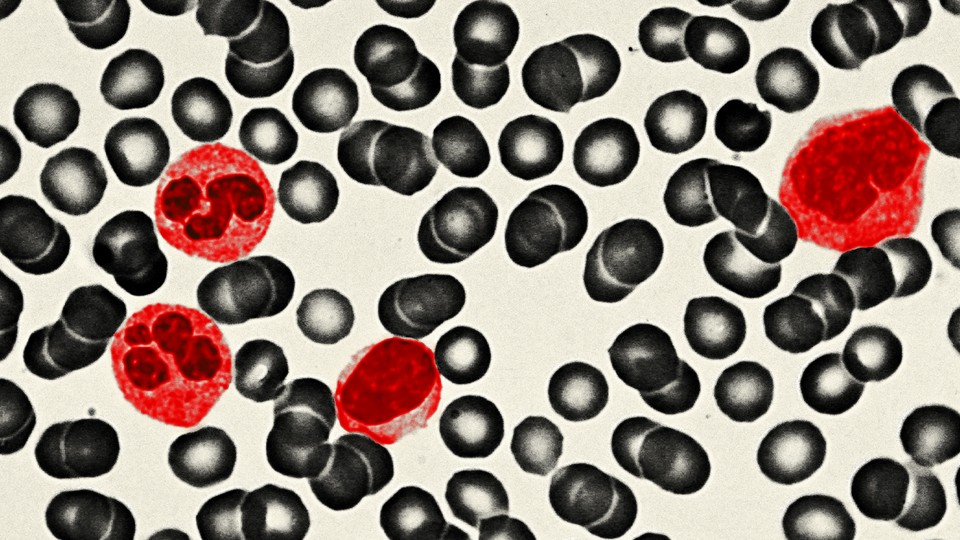 Slide view of four neutrophils, in red, and assorted other cells