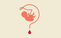 Illustration of an umbilical cord as a question mark
