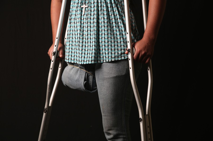 Костыли ампутация. Костыли для инвалидов с одной ногой. Инвалид на костылях. Прогулка на костылях. Парень на костылях.