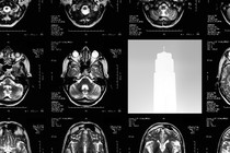 A series of brain scans interrupted by an image of a drug-injection pen