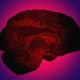 An illustration of a brain