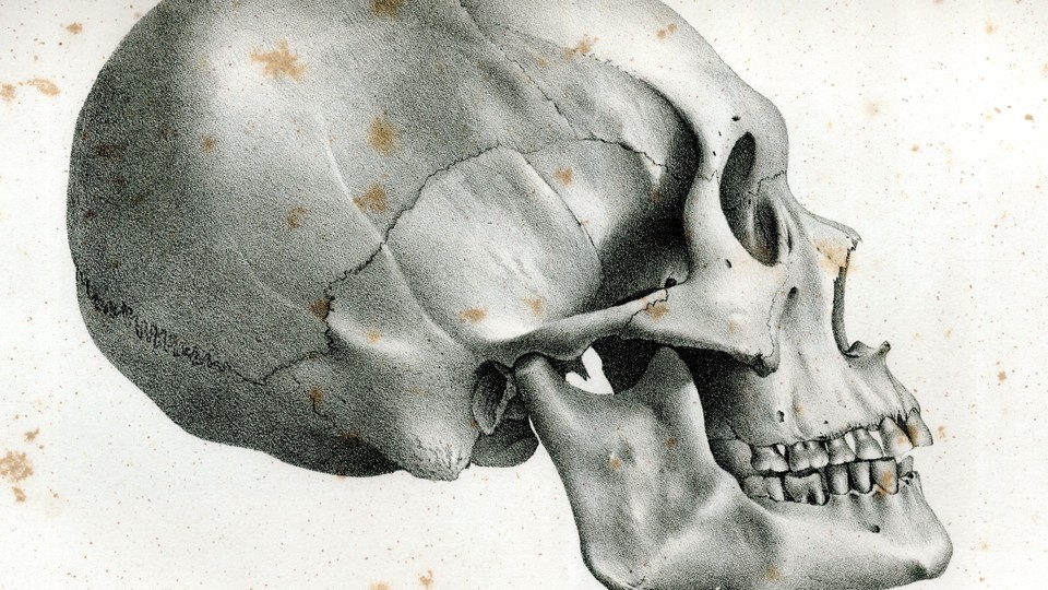 A diagram of an "ancient Peruvian skull" from Samuel George Morton's <i>Crania Americana</i>