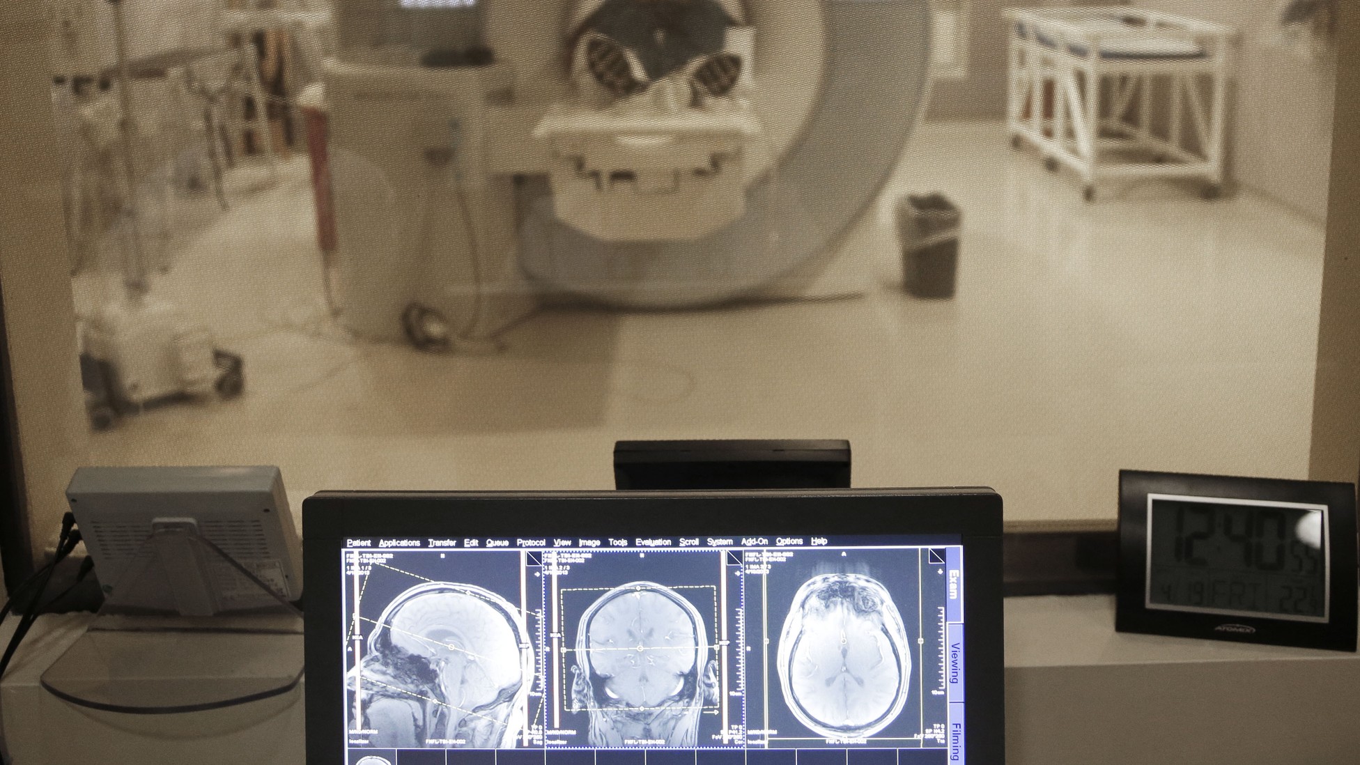 Brain Volume Could Reveal Signs of CTE in the Living - The Atlantic