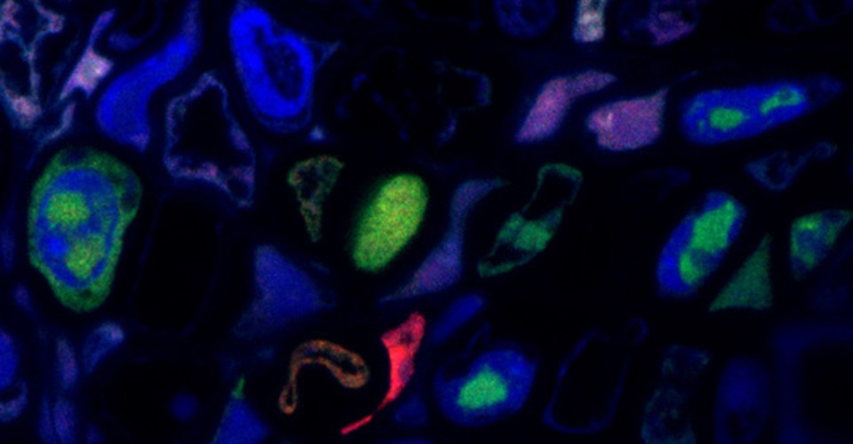 The Revolutionary Discovery of a Distributed Virus The Atlantic
