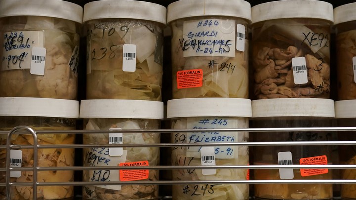Human brains stored in jars filled with formaldehyde on shelves