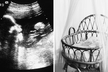 An ultrasound image and a photo of an empty cradle