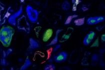 Plant cells (blue) infected by different virus segments (red and green)