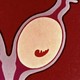 an animation of an embryo developing in a uterus but then being paused