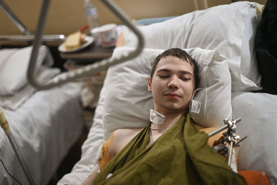An injured young man lies in a hospital bed with metal rods attached to his left arm.