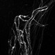 A black and white image of jellyfish tendrils