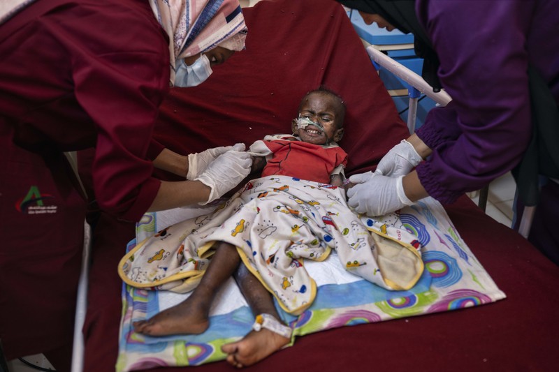 A baby hooked to an IV