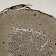 An image of the cerebellum
