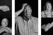 gif of multiple black-and-white photographs of lightning-strike survivors and scars