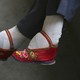 Feet distorted by foot-binding