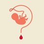 Illustration of an umbilical cord as a question mark