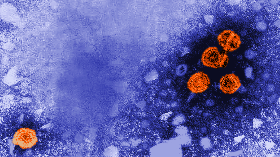 Hepatitis B, The Oldest Virus Ever Sequenced - The Atlantic