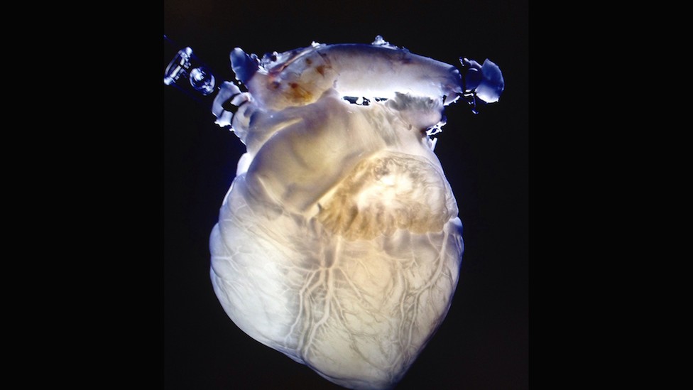 The Built-From-Scratch Heart - The Atlantic
