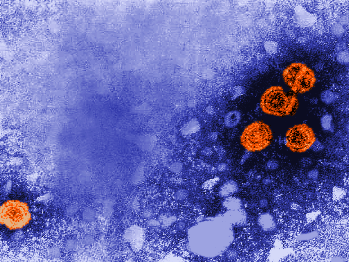 Hepatitis B, the Oldest Virus Ever Sequenced - The Atlantic