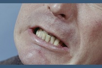 An image of a man clenching his teeth