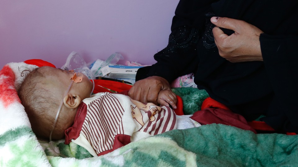A Yemeni mother sits beside her child, who is suffering from acute malnutrition, at a medical center in Sana'a, Yemen, on February 28, 2023.