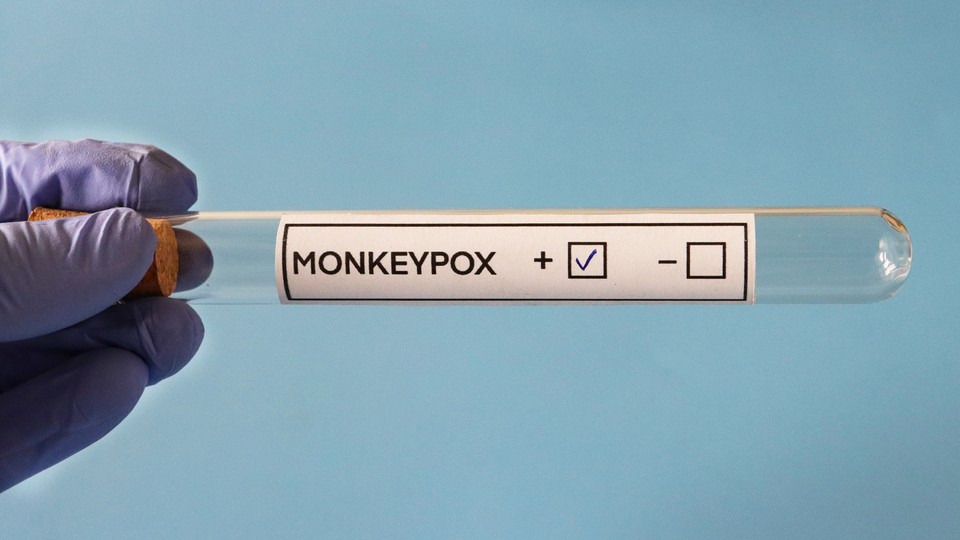 An empty vial marked "Monkeypox," with a + and - box.