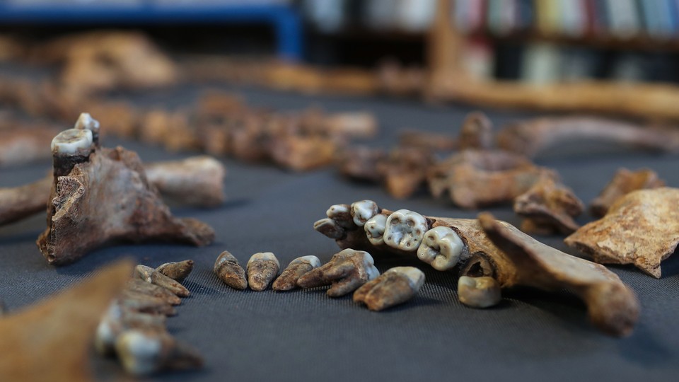 Skeleton teeth on a tablecloth