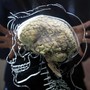 A brain sits inside a glass etching of a human skull.