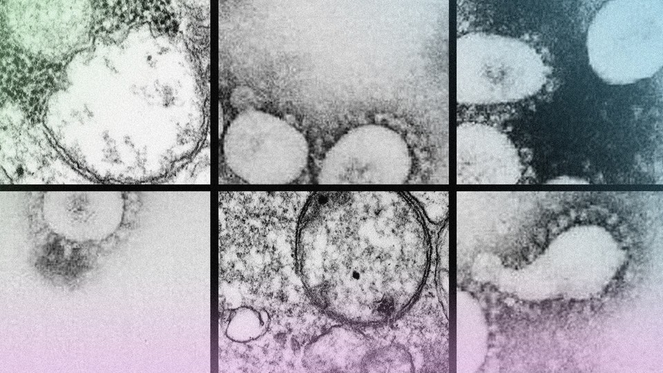 A colorful grid of SARS-CoV-2 under a microscope