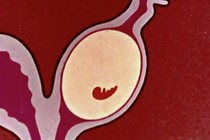an animation of an embryo developing in a uterus but then being paused