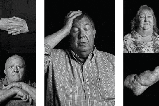 gif of multiple black-and-white photographs of lightning-strike survivors and scars